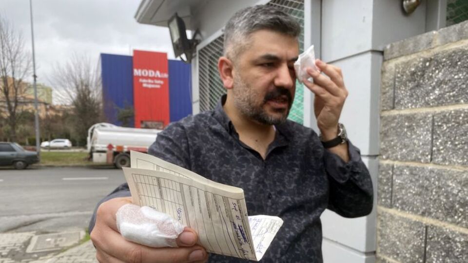 Müdürden veliyi hastanelik eden dayak!