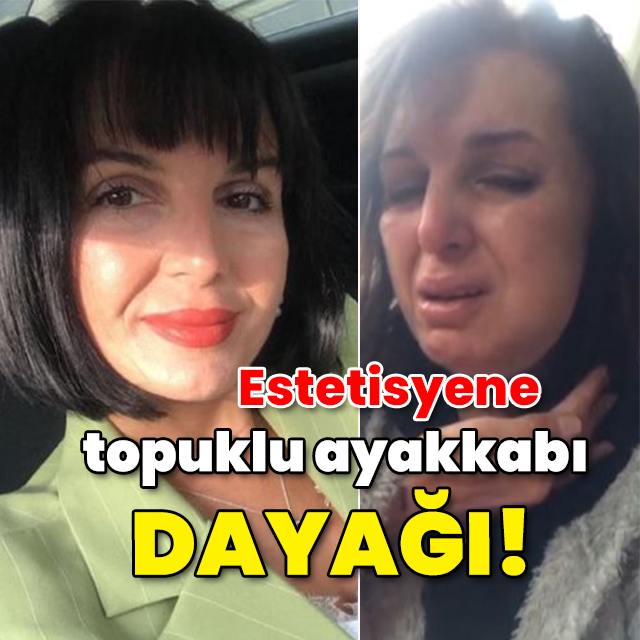 Estetisyene topuklu ayakkabı dayağı!