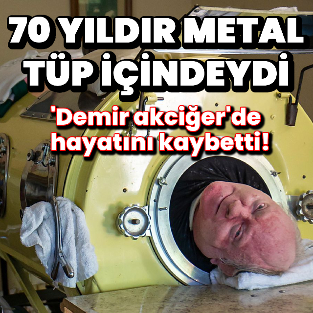 70 yıldır metal tüpün içinde yaşayan adam öldü