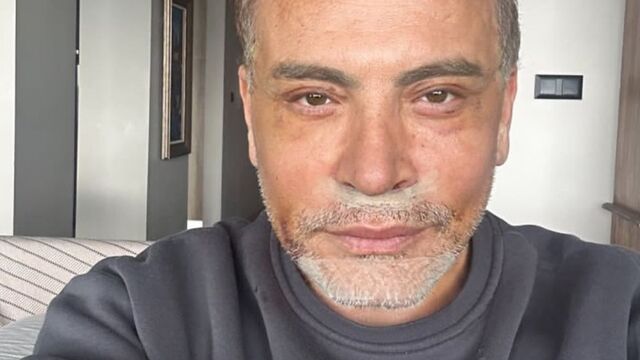 Estetik yaptırdı