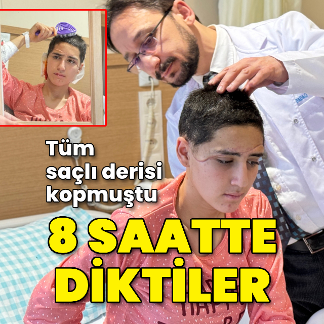 Genç kızın kopan saçlı derisini 8 saatte diktiler!