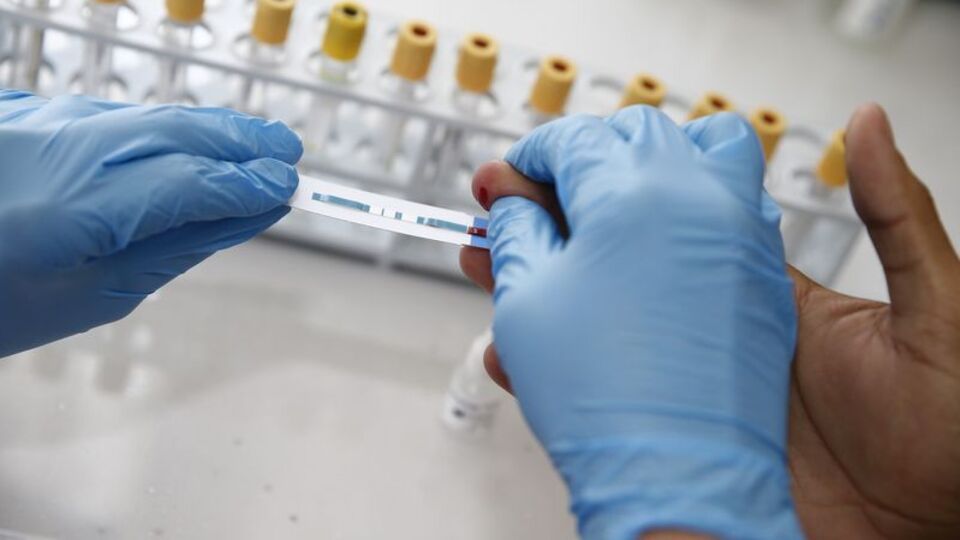 AIDS'te yeni tedavi umudu: HIV'i hücreden ayırma denemesi başarılı oldu