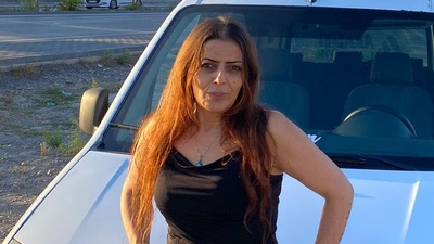 Estetik yaptırdı hayatını kaybetti: İhmal iddiası