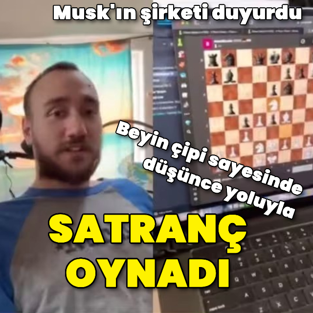 Neuralink: Beyin çipli hasta düşünce yoluyla satranç oynadı