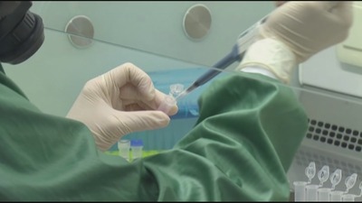 Kolon kanseri en sık görülen 3. kanser türü