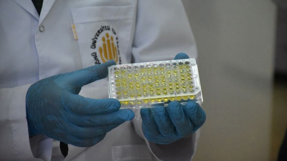 Karabük İl Sağlık Müdürlüğü'nden HIV açıklaması