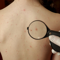  Su çiçeği kimler için tehlikeli?