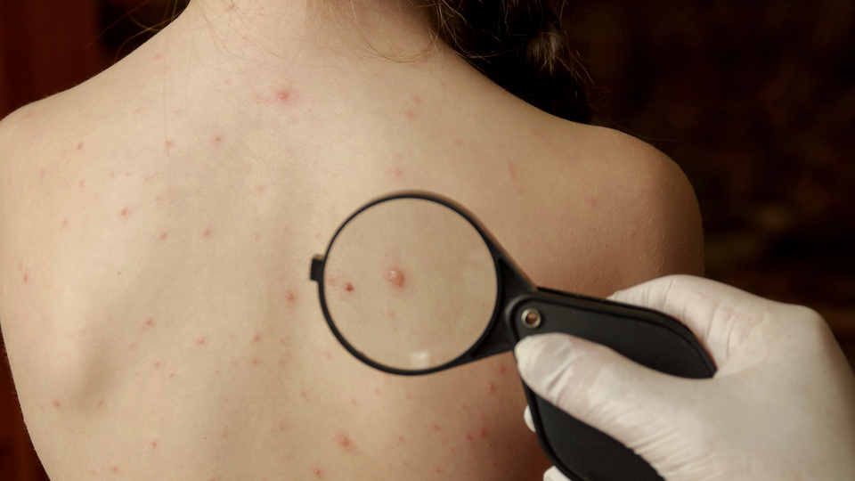 Su çiçeği kimler için tehlikeli?