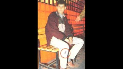 Katil, karakolda pantolonundaki lekeden fark edildi!