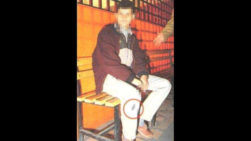 Katil, karakolda pantolonundaki lekeden fark edildi!