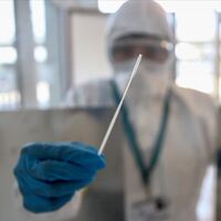 Virüsler insanlardan hayvanlara bulaşıyor!