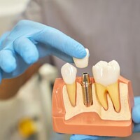 İmplant diş bakımı nasıl yapılır?