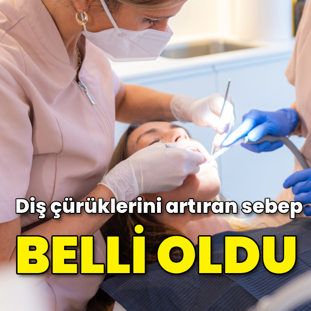 Diş çürüklerini artıran sebep belli oldu!