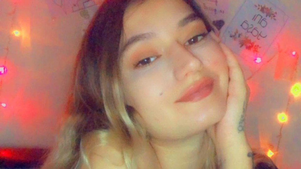 Burnunun ucu çöktü! 1 milyon TL'lik estetik davası