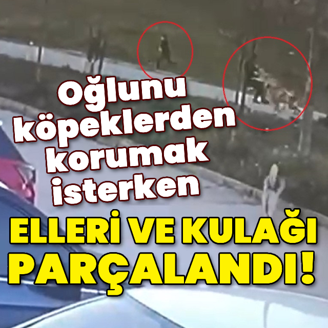 Oğlunu köpeklerden korumak isterken elleri ve kulağı parçalandı!