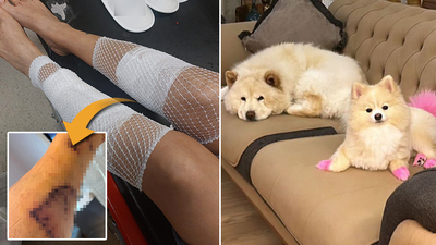 Kıskanç köpek, sahibini hastanelik etti