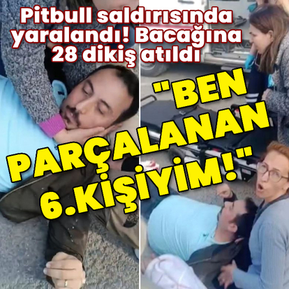Pitbull saldırısında yaralandı! 28 dikiş atıldı