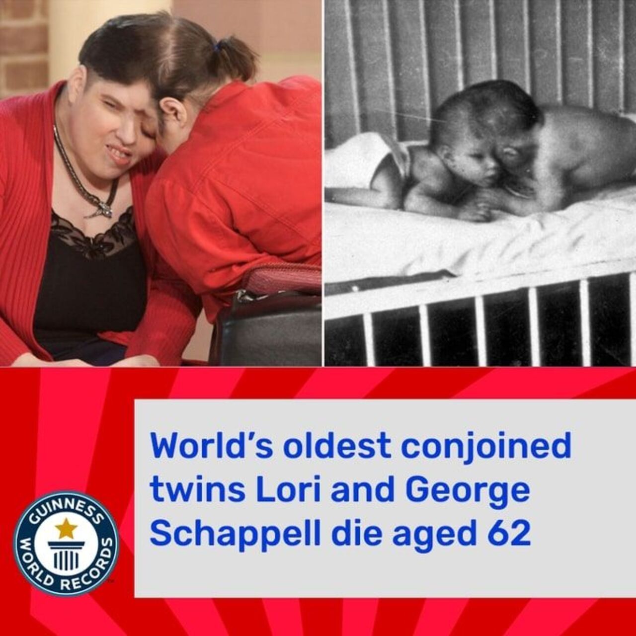 Dünyanın en yaşlı yapışık ikizlerinden kötü haber