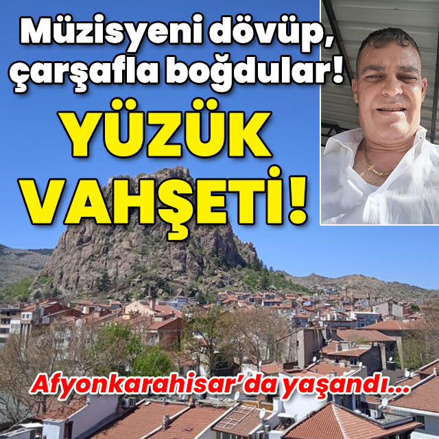 Müzisyeni dövüp, çarşafla boğdular! Yüzük vahşeti!