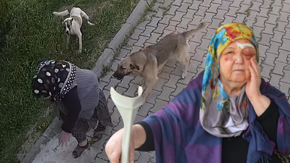 Sahipsiz köpeklerden kaçarken bu hale geldi