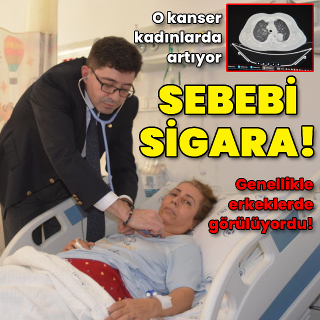 Sebebi sigara!