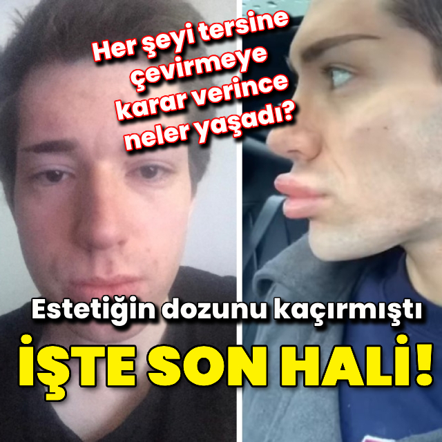 Estetiğin dozunu kaçırmıştı! Son kararı şaşırttı!