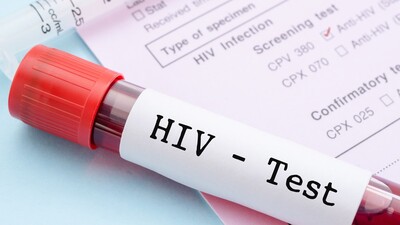 Yanlış AIDS teşhisi davasında karar!