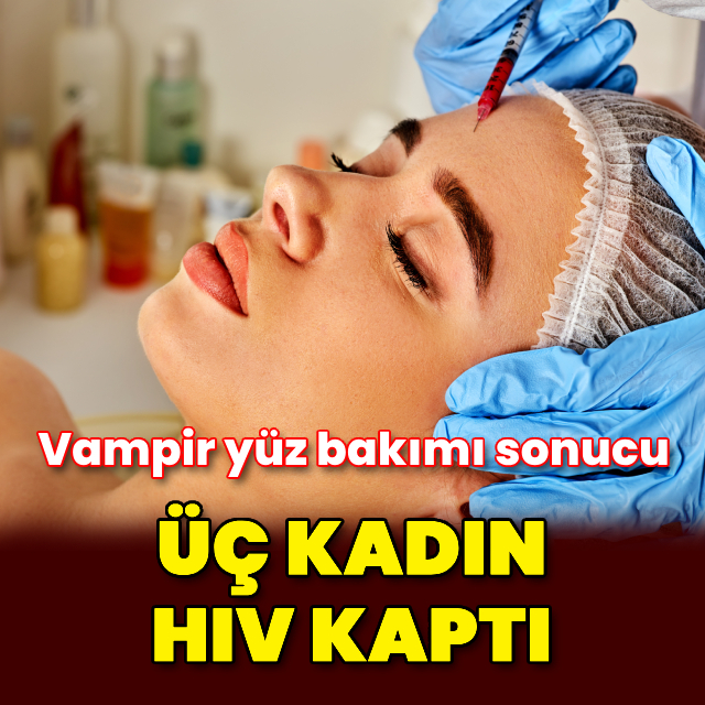 Vampir yüz bakımı sonucu 3 kadın HIV kaptı