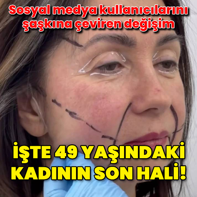 49 yaşındaki kadının son hali şaşırttı!
