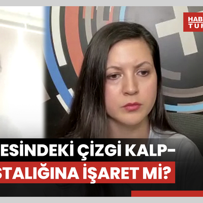 Kulak memesindeki çizgi kalp-damar hastalığına işaret mi?