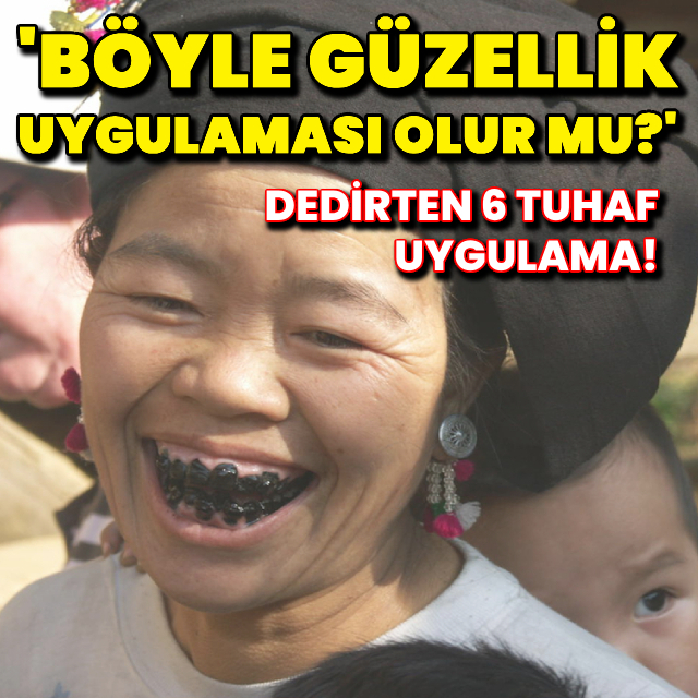 Tarihte yaşanmış 6 tuhaf güzellik uygulaması!