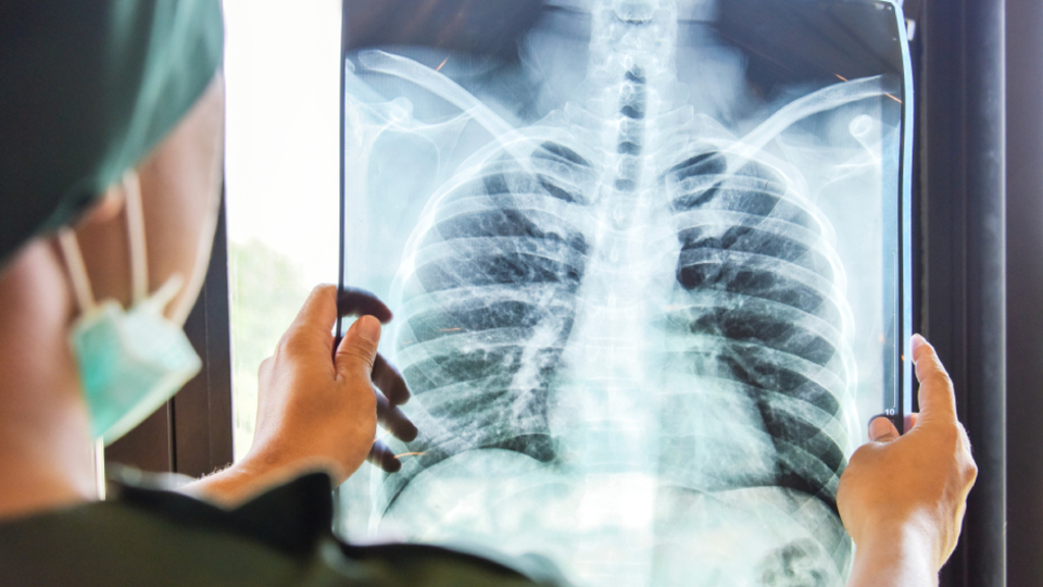 Prof. Dr. Özlü: Astıma bağlı ölümler en çok genç yaşta