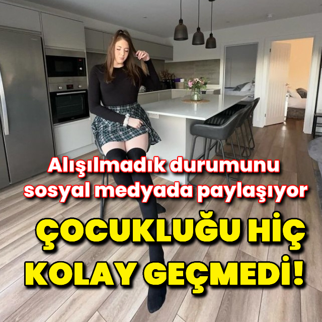 2 metre 13 santimetre uzunluğundaki kadın görenleri şaşırtıyor!