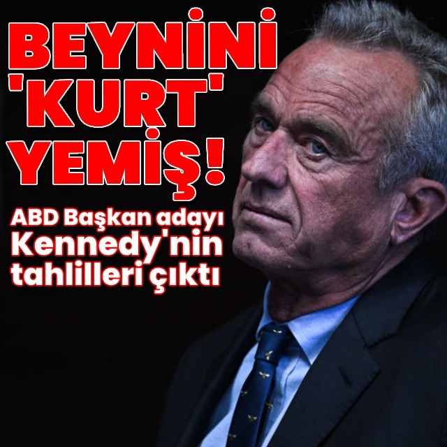 Başkan adayı Kennedy'nin beynini solucan yemiş