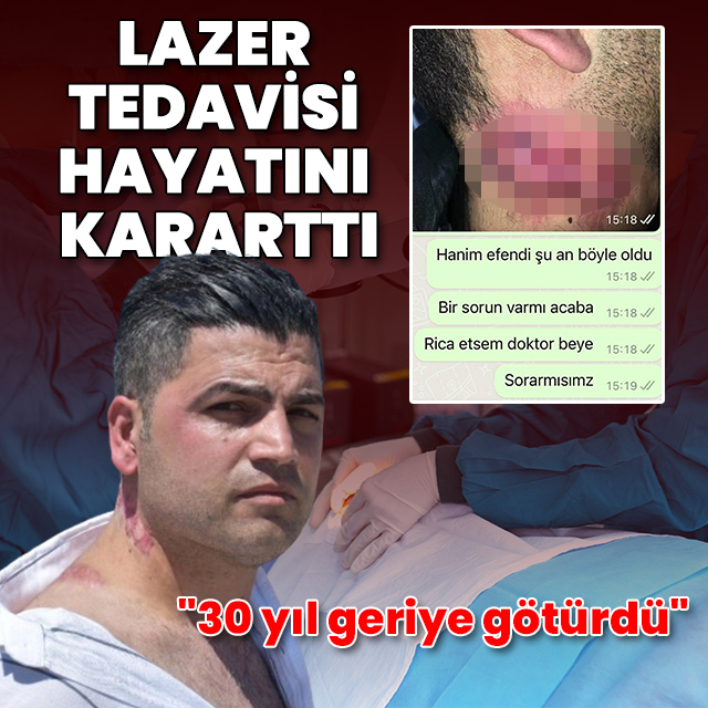 Lazer tedavisi hayatını kararttı: 30 yıl geriye götürdü