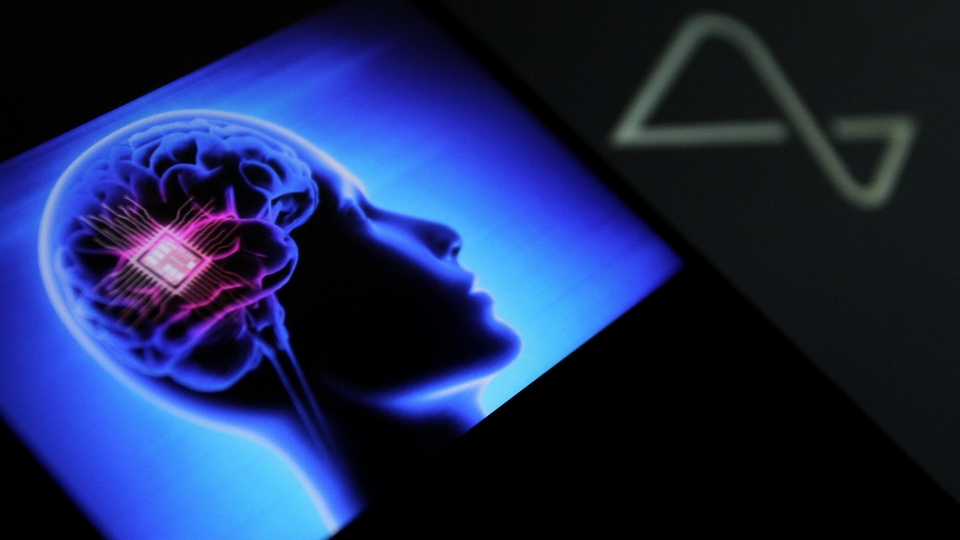 İlk kez insan kafatasına yerleştirilen çipte sorun çıktı