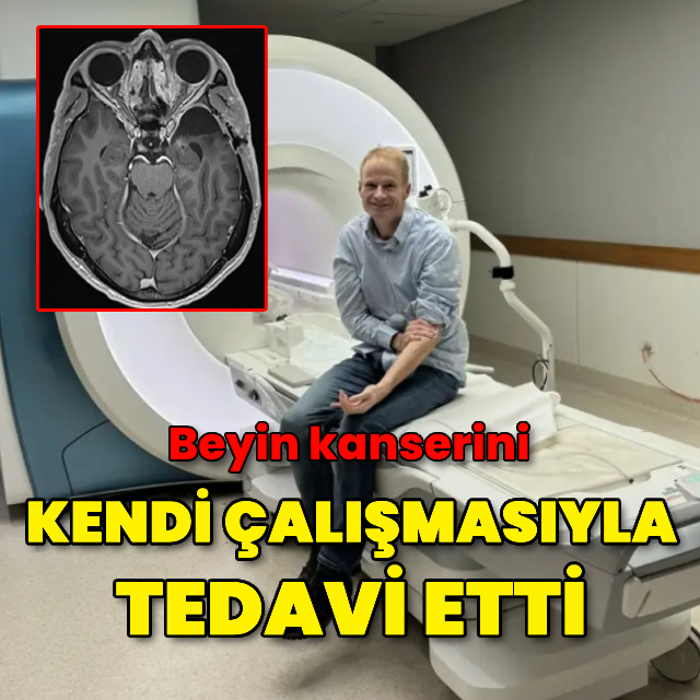 Avustralyalı doktor, beyin kanserini kendi çalışmasıyla tedavi etti