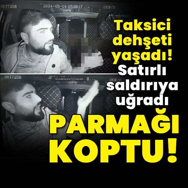 Satırlı saldırdığı taksicinin parmağını kopardı!