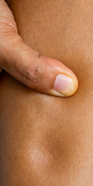  Ödem attırmaya yarayabilecek 9 besin!