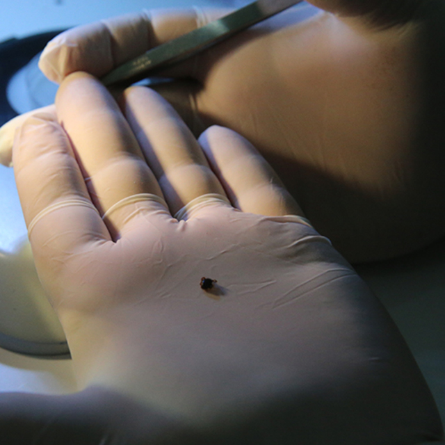  Keneler 200 civarında hastalığın taşıyıcısı