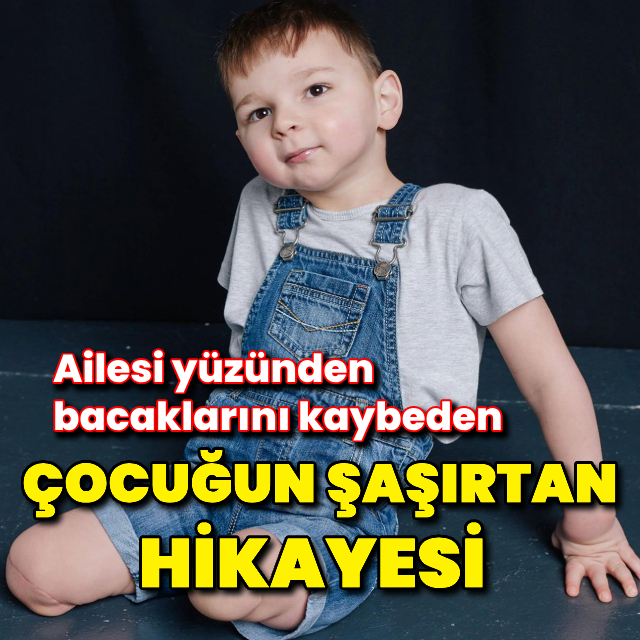 Bacaklarını kaybeden çocuğun iyileşme hikayesi!