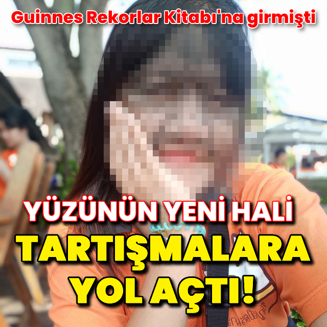 Yüzünün yeni hali tartışmalara yol açtı!