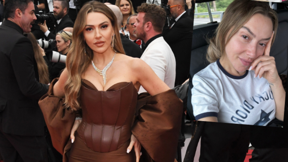 Hadise'nin iki hâli