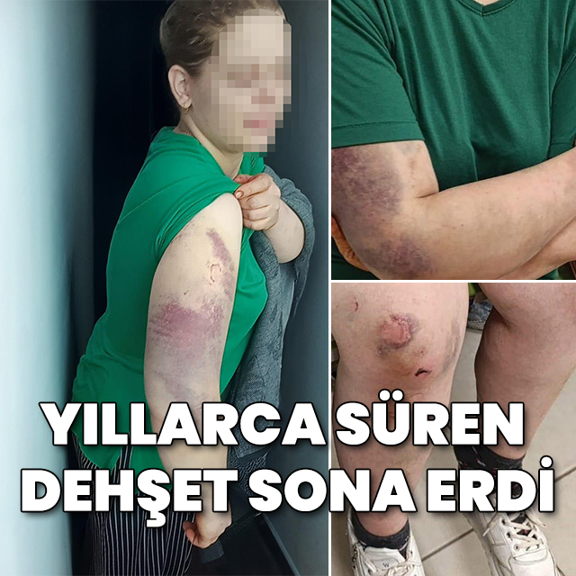 9 yıldır eşine eziyet eden koca tutuklandı