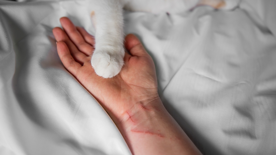 Kedi tırmığı hastalığına dikkat!