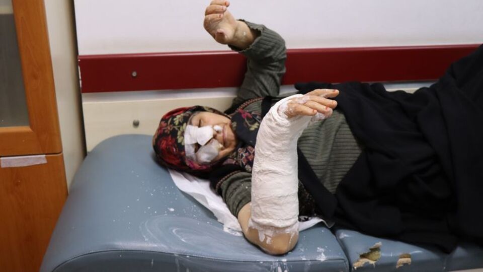 4 sokak köpeği saldırdı! Merdivenden düştü!