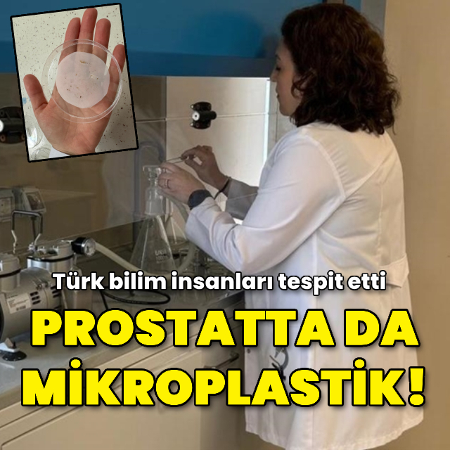 Türk bilim insanları prostatta mikroplastik tespit etti