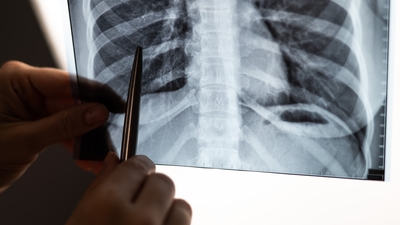 "Yaşamınıza 15-20 yıl eklemek için sigarayı bırakın"