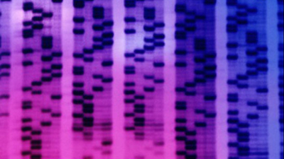 Prostat kanserinde erken teşhis için tükürük testi geliştirdi