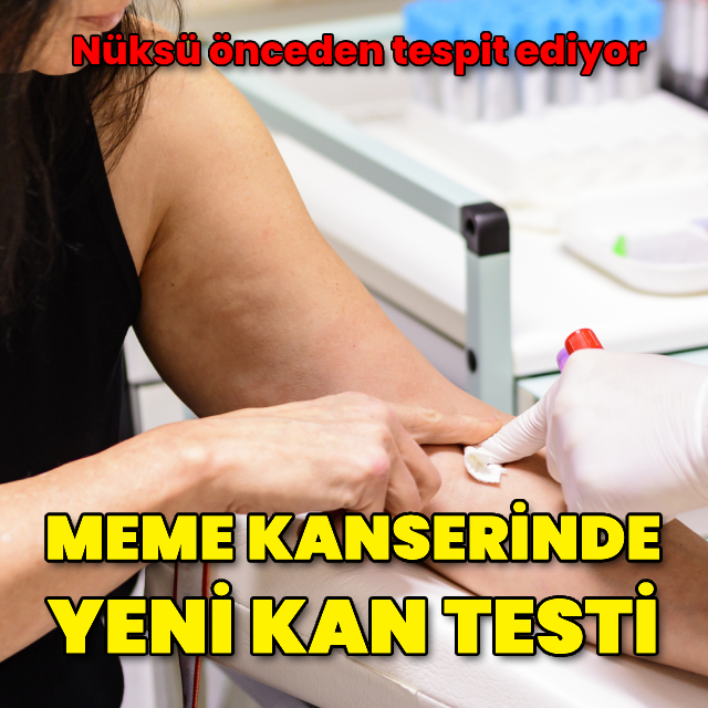 Meme kanserinde yeni kan testi! Nüksü erkenden saptayabiliyor